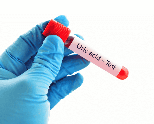 URIC ACID